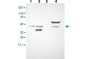 Western blot analysis of Lane 1: RT-4, Lane 2: EFO-21, Lane 3: U-138 MG, Lane 4: Liver, Lane 5: Tonsil with ACOT4 polyclonal antibody . (ACOT4 抗体)
