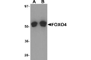 Western Blotting (WB) image for anti-Forkhead Box O4 (FOXO4) (N-Term) antibody (ABIN1031692) (FOXO4 抗体  (N-Term))