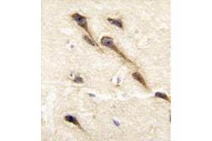 Image no. 2 for anti-Cytochrome P450, Family 26, Subfamily B, Polypeptide 1 (CYP26B1) (C-Term) antibody (ABIN360415)