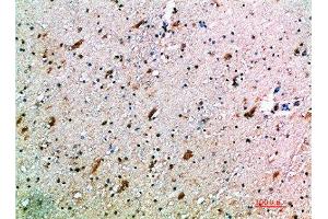 Immunohistochemistry (IHC) image for anti-Killer Cell Lectin-Like Receptor Subfamily K, Member 1 (KLRK1) (AA 167-216) antibody (ABIN7189454)
