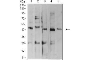 Western blot analysis using ARFGAP1 mouse mAb against MOLT4 (1), C2C12 (2), HepG2 (3), MCF-7 (4), and Lncap (5) cell lysate. (ARFGAP1 抗体  (AA 270-414))