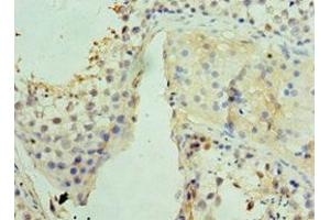 Immunohistochemistry of paraffin-embedded human testis tissue using ABIN7159832 at dilution of 1:100 (UCP1 抗体  (AA 1-307))