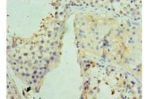 Immunohistochemistry of paraffin-embedded human testis tissue using ABIN7159832 at dilution of 1:100 (UCP1 抗体  (AA 1-307))