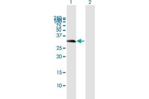 Western Blot analysis of C16orf57 expression in transfected 293T cell line by C16orf57 MaxPab polyclonal antibody. (C16orf57 抗体  (AA 1-265))