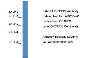 WB Suggested Anti-ZPBP2  Antibody Titration: 0. (ZPBP2 抗体  (N-Term))