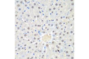 Immunohistochemistry of paraffin-embedded rat liver using WDR48 antibody at dilution of 1:100 (40x lens). (WDR48 抗体)