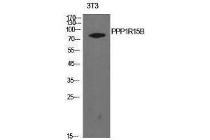 Western Blotting (WB) image for anti-Protein Phosphatase 1, Regulatory Subunit 15B (PPP1R15B) (Internal Region) antibody (ABIN3181424) (PPP1R15B 抗体  (Internal Region))