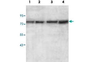 Western blot analysis of HepG2 (Lane 1), HeLa (Lane 2), MCF-7 (Lane 3) and SW480 (Lane 4) cell lysate with AGPS polyclonal antibody  at 1 : 500 dilution. (AGPS 抗体  (AA 462-632))