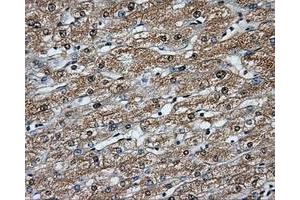 Immunohistochemical staining of paraffin-embedded liver tissue using anti-BTK mouse monoclonal antibody. (BTK 抗体)