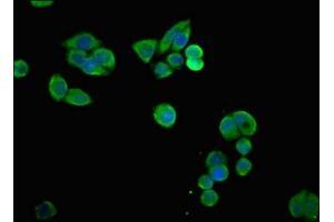 Immunofluorescence (IF) image for anti-Solute Carrier Family 6 (Neurotransmitter Transporter, Creatine), Member 8 (SLC6A8) (AA 582-635) antibody (ABIN7169948)
