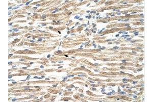 Image no. 1 for anti-YY1 Associated Factor 2 (YAF2) (AA 46-95) antibody (ABIN203352) (YAF2 抗体  (AA 46-95))