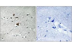 Immunohistochemistry (IHC) image for anti-Anaphase Promoting Complex Subunit 1 (ANAPC1) (AA 321-370) antibody (ABIN2889133) (APC1 抗体  (AA 321-370))