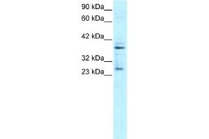 WB Suggested Anti-SIRT5 Antibody Titration:  0. (SIRT5 抗体  (C-Term))