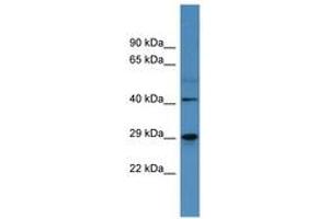 Image no. 1 for anti-Carbonic Anhydrase II (CA2) (AA 130-179) antibody (ABIN6746751) (CA2 抗体  (AA 130-179))