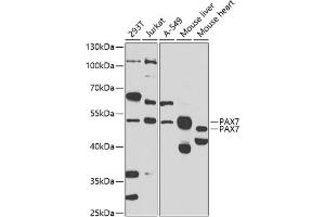 Western blot analysis of extracts of various cell lines, using P antibody (ABIN6132464, ABIN6145263, ABIN6145265 and ABIN6223179) at 1:1000 dilution. (PAX7 抗体  (AA 289-518))