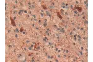 Immunohistochemistry (IHC) image for anti-Ubiquitin Carboxyl-terminal Esterase L1 (Ubiquitin Thiolesterase) (UCHL1) (AA 2-223) antibody (ABIN7436390)