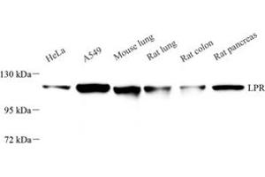 Western blot analysis of LRP (ABIN7074548) at dilution of 1: 500 (MVP 抗体)