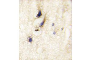 Formalin-fixed and paraffin-embedded human brain tissue reacted with DM1 Antibody (C-term) (ABIN389180 and ABIN2839343) , which was peroxidase-conjugated to the secondary antibody, followed by DAB staining. (DAAM1 抗体  (C-Term))