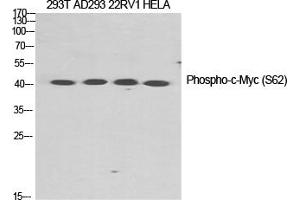 Western Blotting (WB) image for anti-Myc Proto-Oncogene protein (MYC) (pSer62) antibody (ABIN5959056) (c-MYC 抗体  (pSer62))