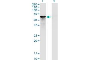 Splicing Factor 1 抗体  (AA 1-110)