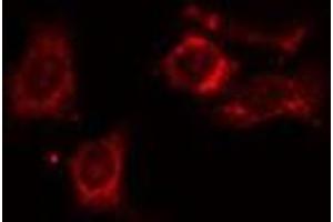 ABIN6275406 staining HT29 cells by IF/ICC. (NDRG4 抗体  (Internal Region))