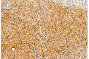 ABIN6262815 and ABIN6272922 at 1/100 staining Rat kidney tissue by IHC-P.