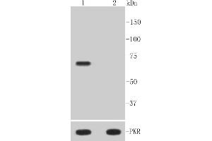 Lane 1: Hela treated with Calyculin A and TNF-alpha whole cell lysates, Lane 2: Untreated Hela whole cell lysates, probed with PKR(T446) (10A1) Monoclonal Antibody  at 1:1000 overnight at 4˚C. (EIF2AK2 抗体  (pThr446))