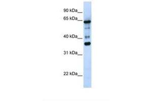 Image no. 1 for anti-Zinc Finger Protein 630 (ZNF630) (AA 218-267) antibody (ABIN6739290)