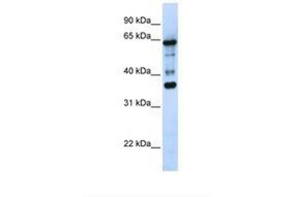 ZNF630 anticorps  (AA 218-267)