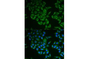 Immunofluorescence analysis of A549 cell using CD247 antibody. (CD247 抗体)