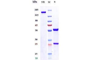 Anti-SLITRK6 Reference Antibody (sirtratumab) on SDS-PAGE under reducing (R) condition. (Recombinant SLITRK6 (Sirtratumab Biosimilar) 抗体)