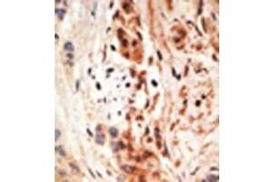 Image no. 2 for anti-Apolipoprotein B mRNA Editing Enzyme, Catalytic Polypeptide-Like 3A (APOBEC3A) (N-Term) antibody (ABIN356863) (APOBEC3A 抗体  (N-Term))