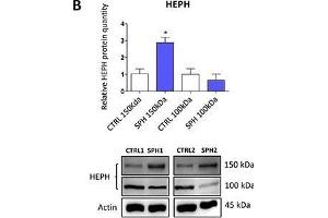 Iron export machinery-related hephaestin (HEPH) and the hemochromatosis gene (HFE) related to systemic iron loading are elevated at the mRNA level but not on the protein level in tumor-initiating cells (TICs)Expression of the HEPH gene at the mRNA level in breast non-malignant cell line MCF10A, in TICs derived from breast cancer cell lines MCF-7, BT-474, T-47D and ZR-75-30 as well as from prostate cancer cell lines DU-145 and LNCaP has been determined (A) together with protein levels in the MCF-7 cell line (CTRL) and MCF-7 derived spheres (SPH) (B). (Hephaestin 抗体  (AA 21-120))