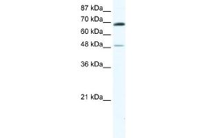 WB Suggested Anti-ZNF35 Antibody Titration:  0. (ZNF35 抗体  (N-Term))