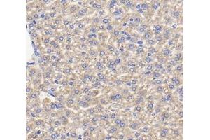 Immunohistochemistry analysis of paraffin-embedded mouse liver using,TFR2 (ABIN7075965) at dilution of 1: 400 (Transferrin Receptor 2 抗体)