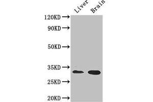 Western Blot Positive WB detected in: Mouse liver tissue, Mouse brain tissue All lanes: CD37 antibody at 2. (CD37 抗体  (AA 109-237))