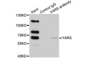 Immunoprecipitation analysis of 200ug extracts of HeLa cells using 1ug YARS antibody. (YARS 抗体)