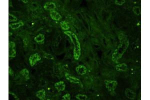 Immunofluorescence (Paraffin-embedded Sections) (IF (p)) image for anti-Mitofusin 2 (MFN2) (AA 1-120) antibody (ABIN682528)