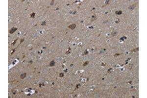 The image on the left is immunohistochemistry of paraffin-embedded Human brain tissue using ABIN7129446(FAM89B Antibody) at dilution 1/30, on the right is treated with fusion protein. (FAM89B 抗体)