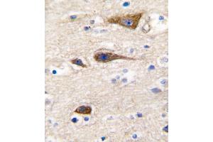 Immunohistochemistry (Paraffin-embedded Sections) (IHC (p)) image for anti-Cytochrome P450, Family 2, Subfamily R, Polypeptide 1 (CYP2R1) (AA 152-180) antibody (ABIN392380)