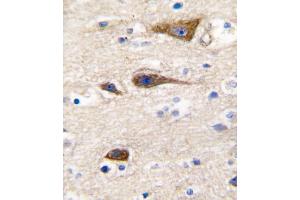 Formalin-fixed and paraffin-embedded human brain tissue reacted with CYP2R1 antibody (Center), which was peroxidase-conjugated to the secondary antibody, followed by DAB staining. (CYP2R1 抗体  (AA 152-180))