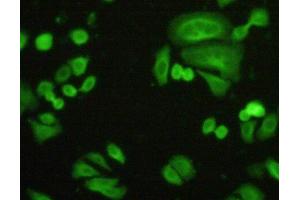 Figure:FITC staining on IHC-P Simple: Hela cells (FLNB 抗体  (AA 1-237))