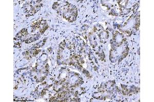 IHC analysis of MCM7 using anti-MCM7 antibody (ABIN7601968). (MCM7 抗体  (AA 526-719))