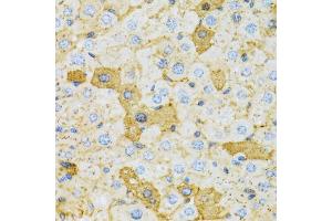 Immunohistochemistry of paraffin-embedded rat liver using OXA1L antibody (ABIN5973722) at dilution of 1/100 (40x lens). (OXA1L 抗体)