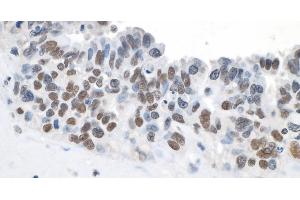 Immunohistochemistry (IHC) image for anti-Topoisomerase (DNA) II beta 180kDa (TOP2B) (C-Term) antibody (ABIN7454697) (TOP2B 抗体  (C-Term))