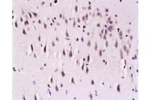 Formalin-fixed and paraffin embedded rat brain labeled with Mouse Anti-Calcineurin A/PP-2B alpha 1 Polyclonal Antibody , Unconjugated 1:200 followed by conjugation to the secondary antibody and DAB staining (Calcineurin A 抗体  (AA 15-80))