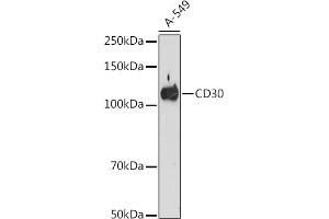 Western blot analysis of extracts of A-549 cells, using CD30 antibody (ABIN7271072) at 1:500 dilution.