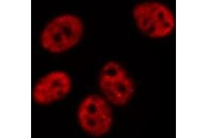 ABIN6275070 staining  Hela cells by IF/ICC. (POLR1B 抗体  (Internal Region))