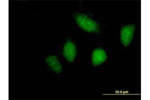 Immunofluorescence of purified MaxPab antibody to LYN on HeLa cell. (LYN 抗体  (AA 1-512))