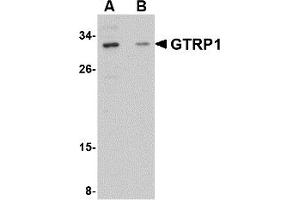 Western Blotting (WB) image for anti-Growth Hormone Regulated TBC Protein 1 (GRTP1) (Middle Region) antibody (ABIN1030945) (GRTP1 抗体  (Middle Region))